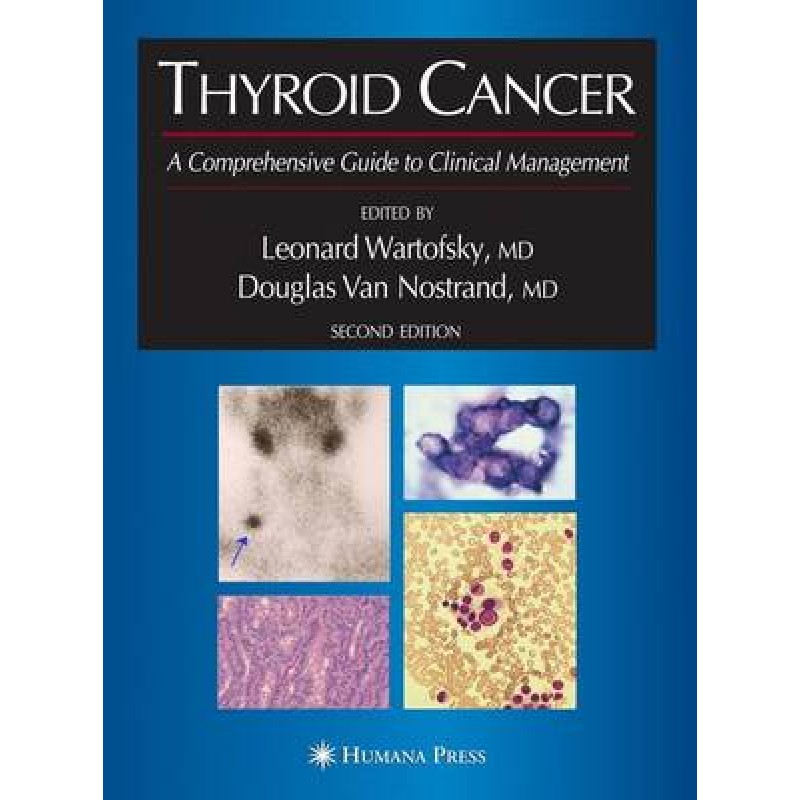 Thyroid Cancer